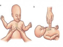 Neonatal Advanced Cardiac Life Care ( BLS + ADD)