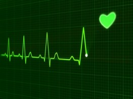 Basics ECG